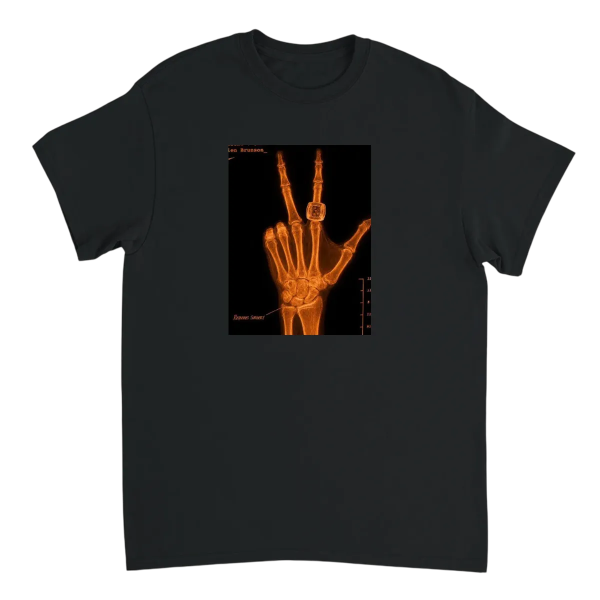 Brunson's "Healthy" Hand X-Ray Meme Tee Black T-Shirts Photo 2