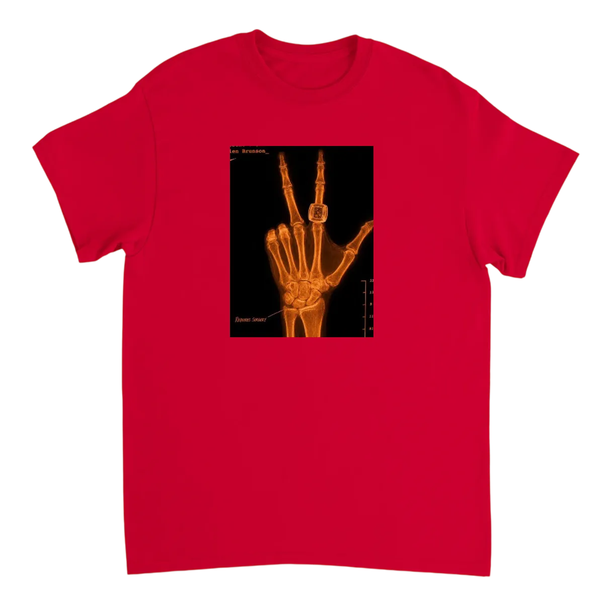 Brunson's "Healthy" Hand X-Ray Meme Tee T-Shirts - Red