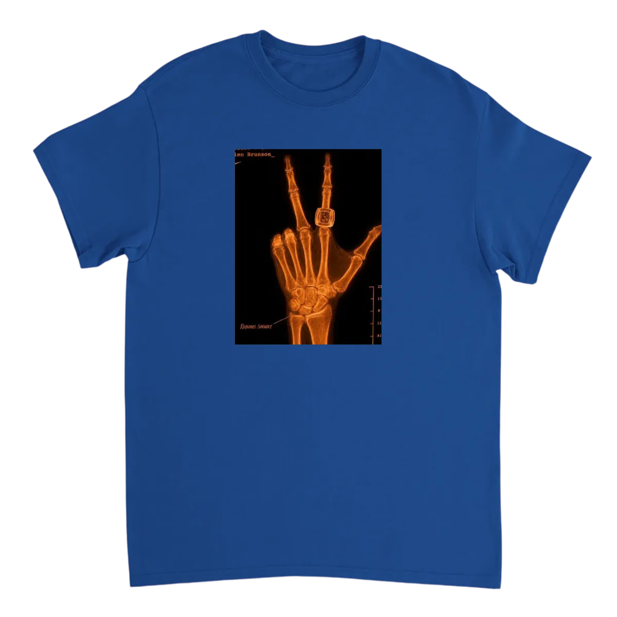 Brunson's "Healthy" Hand X-Ray Meme Tee Black T-Shirts Photo 5