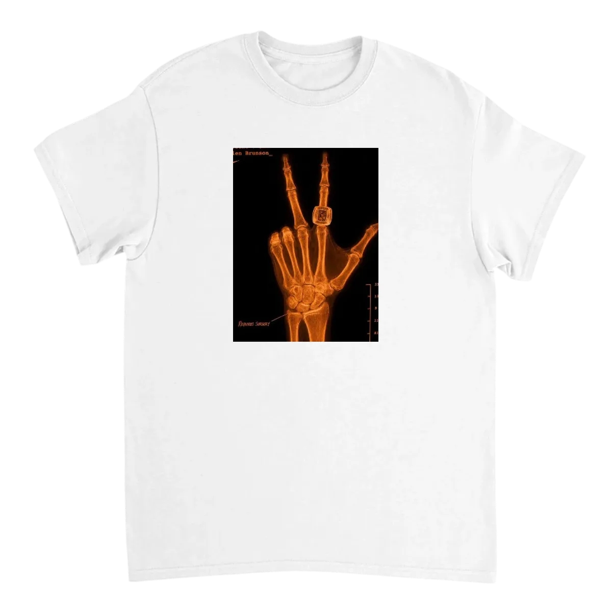 Brunson's "Healthy" Hand X-Ray Meme Tee
